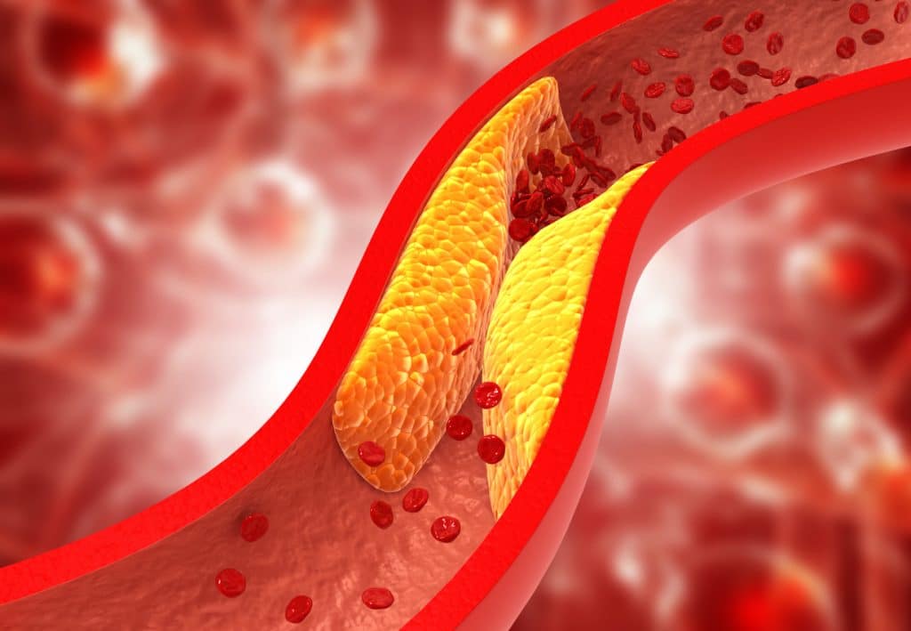 Apolipoprotein Illustration